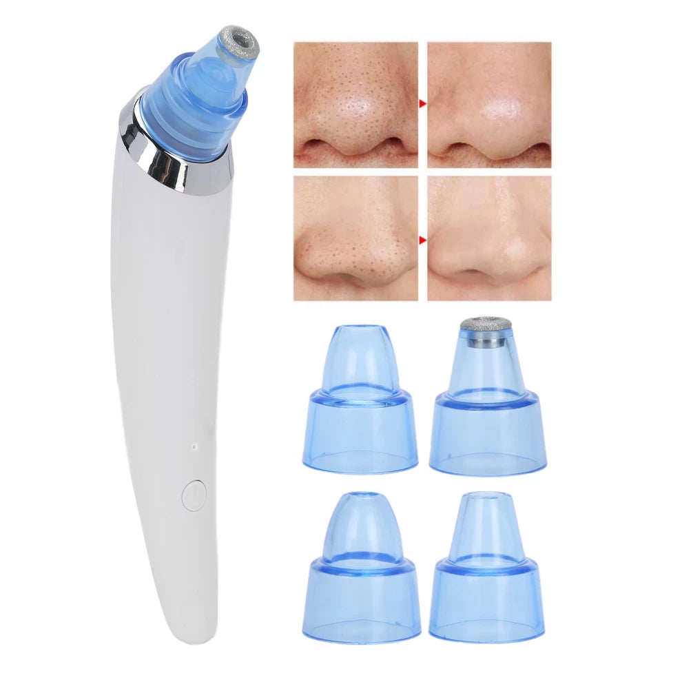 USB Charging Electric Blackhead Comedo Vacuum Suction