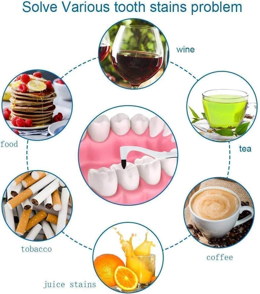 Spin Smile 360 – Professional Grade Tooth Polisher for a Brighter Smile!