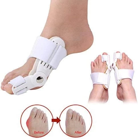 TENICORE Splint Toe Bunion Corrector