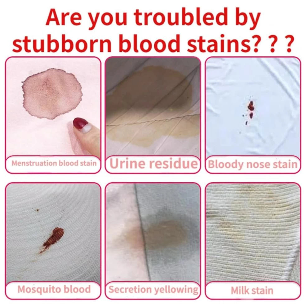 Blood Stain Dry Cleaning Foam-150ml