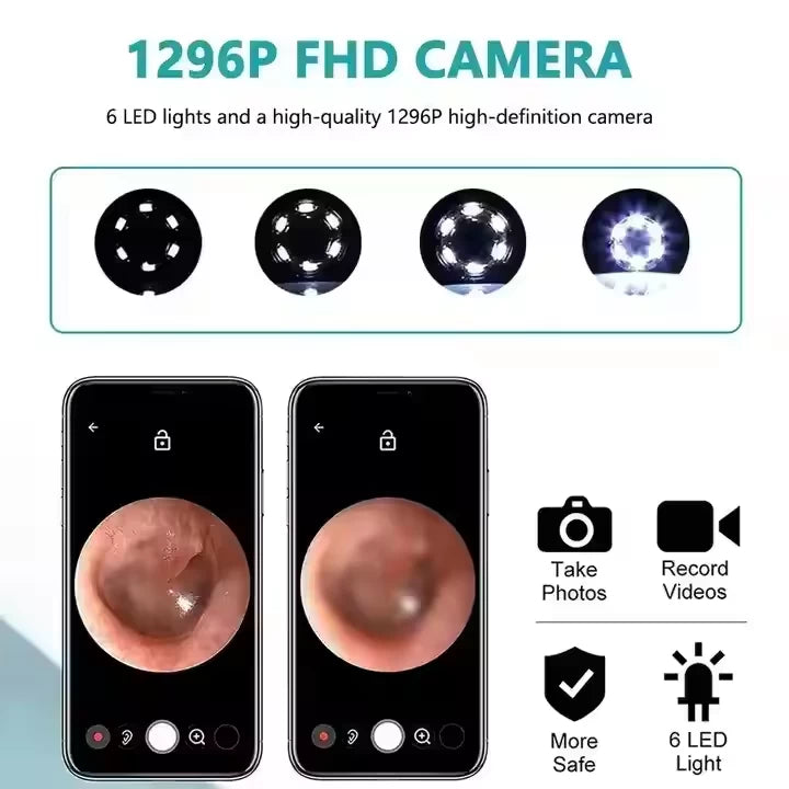 Wireless ear Wax Removal with HD Camera 1080P
